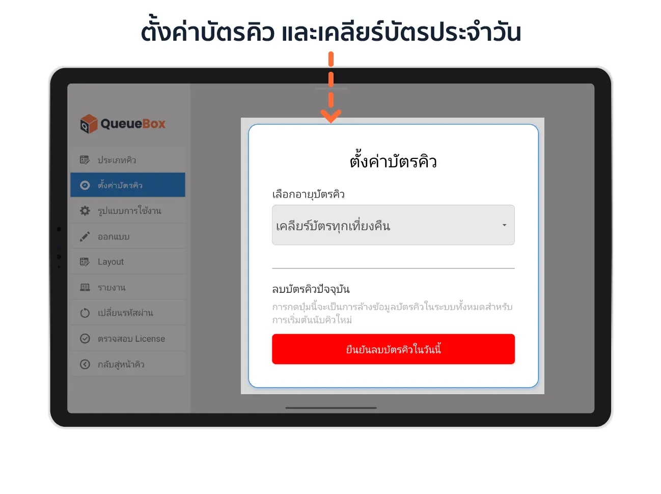 Feature Queue Setting